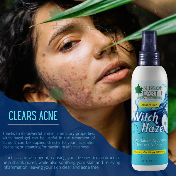 Witch Hazel Astringent